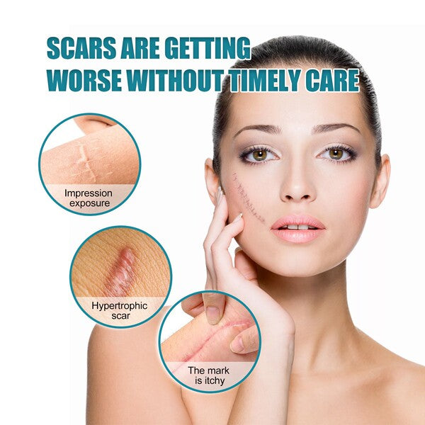 Silicone Scar Care Patch (Advanced Repair Edition) | Self-Adhesive | Reducing Pregnancy and Surgery Scars | Soft Silicone | Scar Care Support | ISMT260715A206