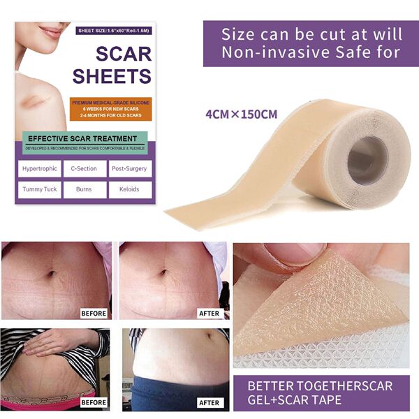 Silicone Scar Care Patch (Advanced Repair Edition) | Self-Adhesive | Reducing Pregnancy and Surgery Scars | Soft Silicone | Scar Care Support | ISMT260715A206