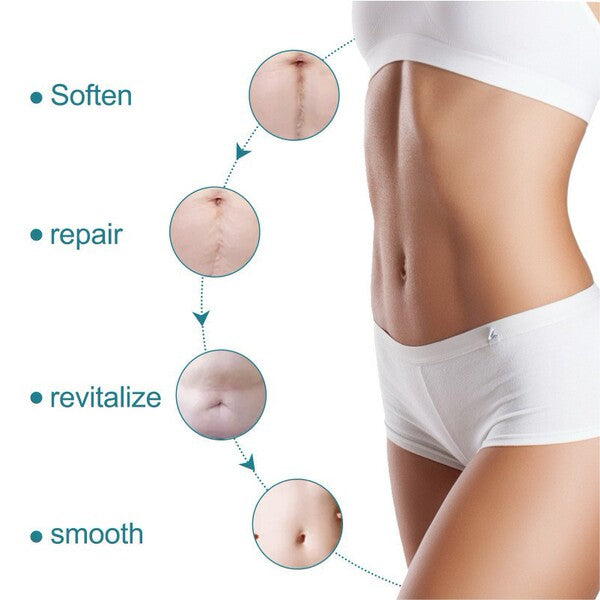 Silicone Scar Care Patch (Advanced Repair Edition) | Self-Adhesive | Reducing Pregnancy and Surgery Scars | Soft Silicone | Scar Care Support | ISMT260715A206